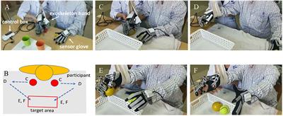 Robot-Assisted Bimanual Training Improves Hand Function in Patients With Subacute Stroke: A Randomized Controlled Pilot Study